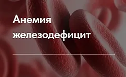Лечебный протокол "Анемия железодефицит"