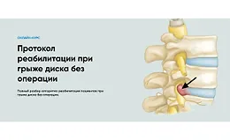 Протокол реабилитации при грыже диска без операции