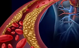 Школа Холестерина