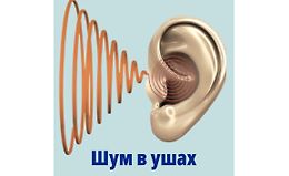 Все о шуме в ушах: видеогайд logo