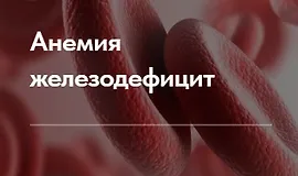 Лечебный протокол "Анемия железодефицит"
