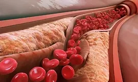 Научитесь снижать холестерин без лекарств