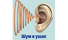 Все о шуме в ушах: видеогайд