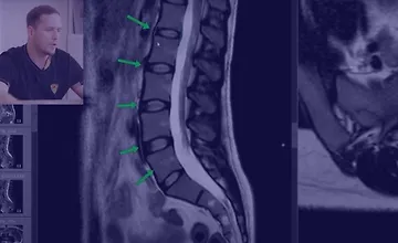 Изображение курса Как читать МРТ поясницы