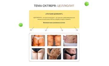 Изображение курса Клуб Здоровье: инструкция к применению. Целлюлит