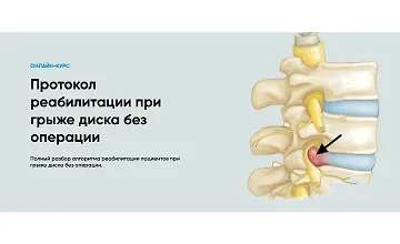 Изображение курса Протокол реабилитации при грыже диска без операции