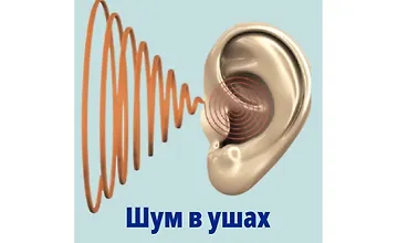 Изображение курса Все о шуме в ушах: видеогайд