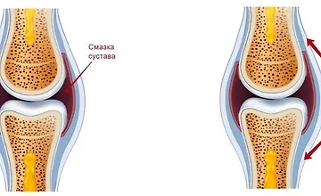 Изображение курса Здоровье суставов ног от А до Я