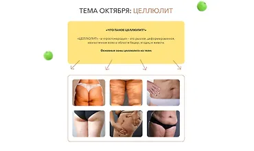 Изображение курса Клуб Здоровье: инструкция к применению. Целлюлит