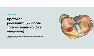 Изображение курса Протокол реабилитации после травмы мениска (без операции)