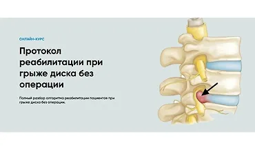 Изображение курса Протокол реабилитации при грыже диска без операции