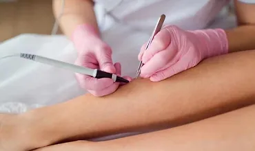 Изображение курса Совеременная Электроэпиляция. Электроэпиляция в идеальном исполнении. Базовый курс