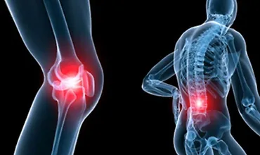 Изображение курса Всё о здоровых суставах и здоровом связочном аппарате