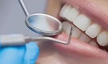 Изображение курса Всё про профилактику и лечение кариеса и его осложнений